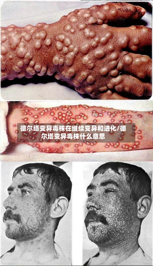 德尔塔变异毒株在继续变异和进化/德尔塔变异毒株什么意思-第2张图片