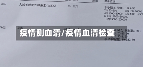 疫情测血清/疫情血清检查-第2张图片